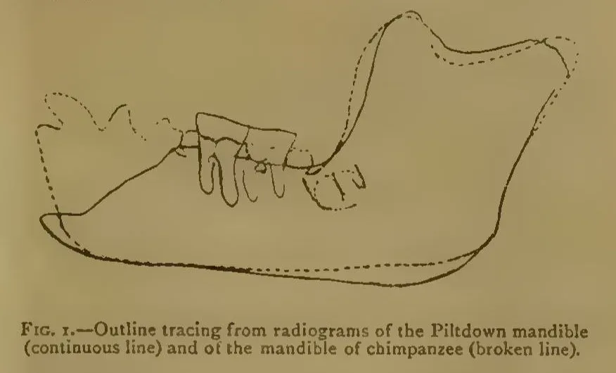 Microscope view of teeth