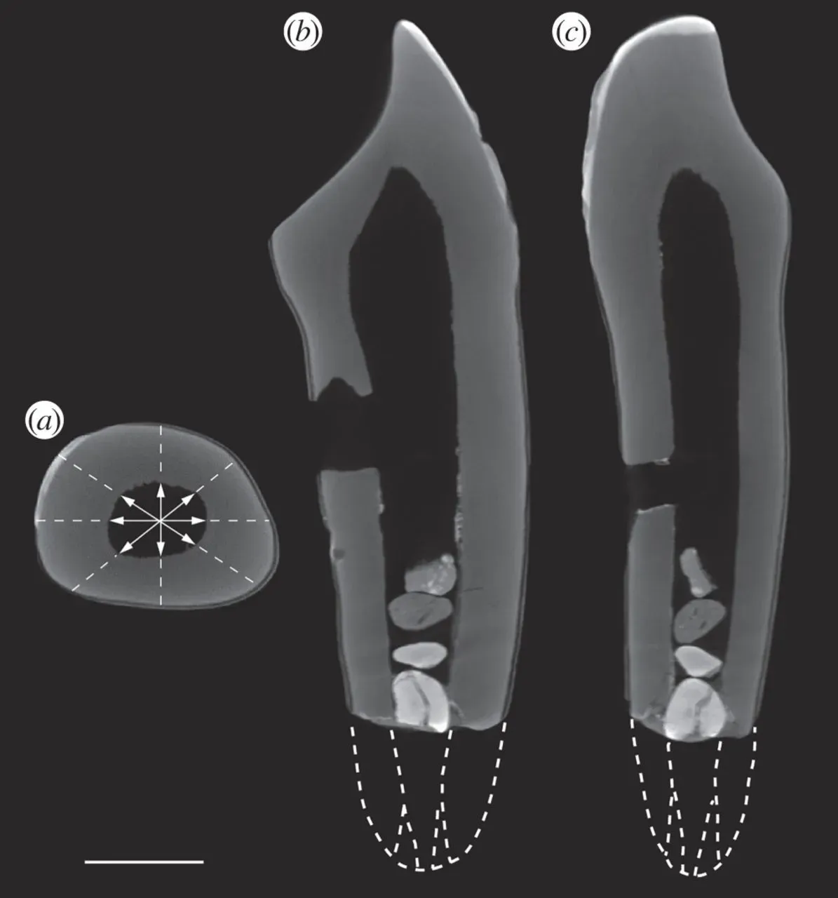 Stained bone fragments