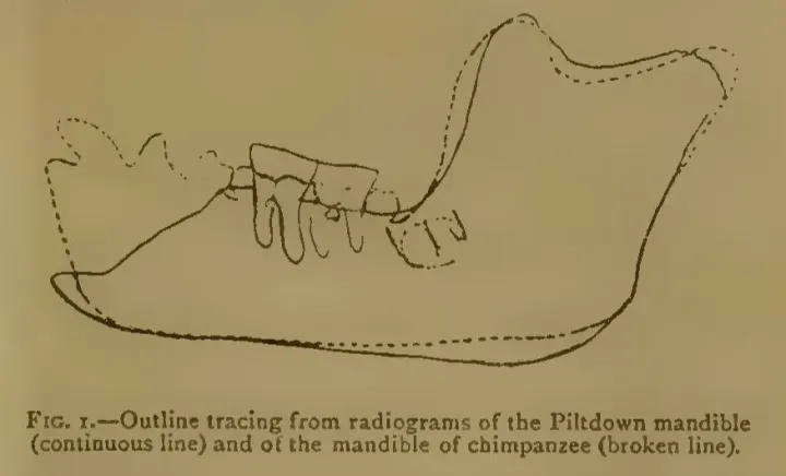 Microscope view of teeth