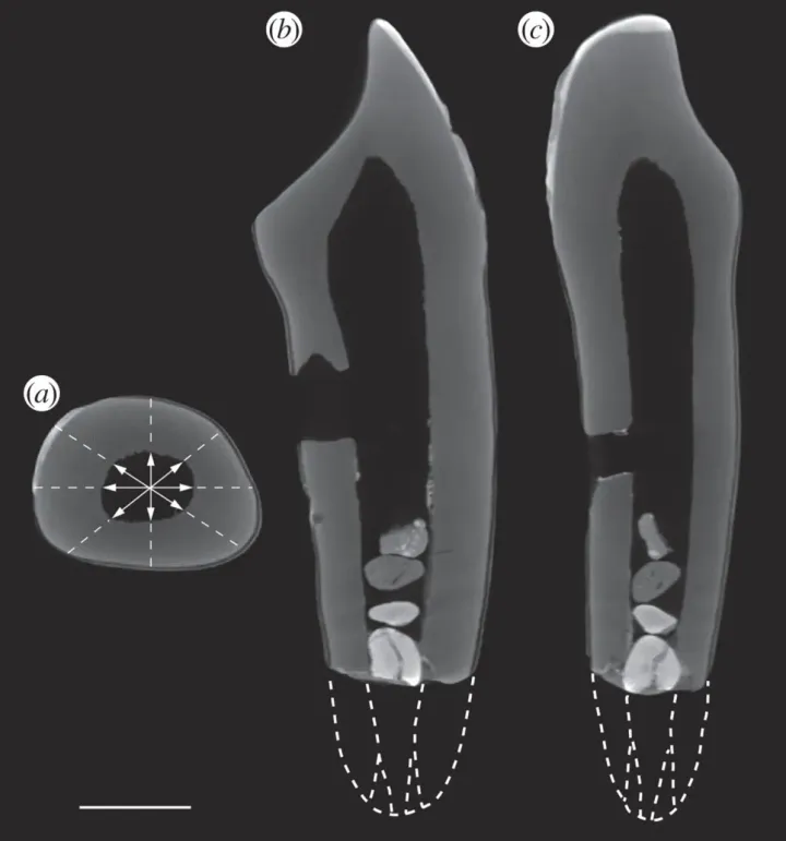 Stained bone fragments