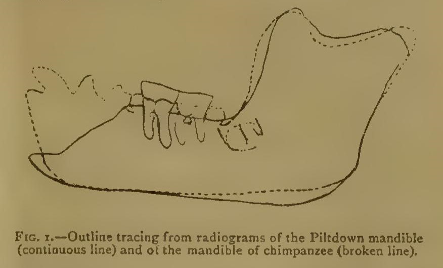 Microscope view of teeth